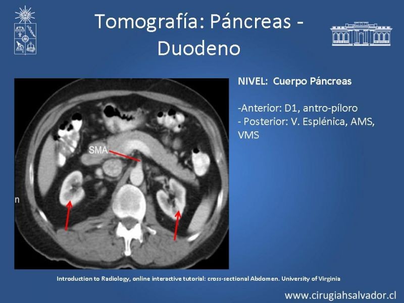 Diapositiva 34 de Anatomía Quirúrgica y Radiología Aplicada