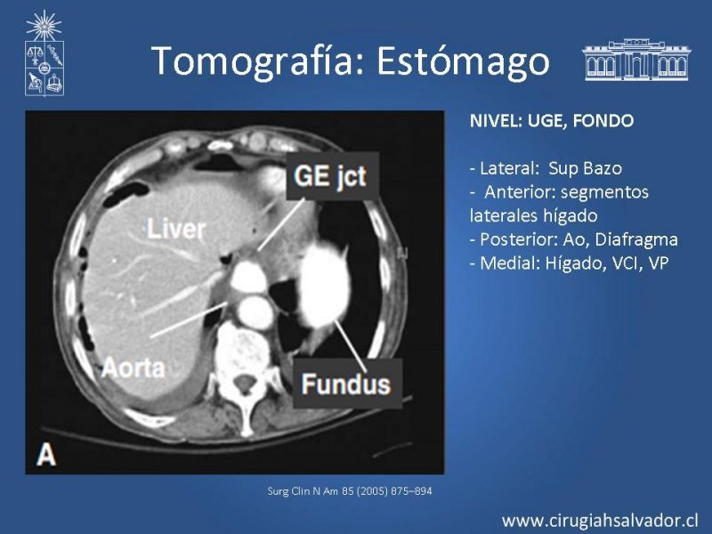 Diapositiva 22 de Anatomía Quirúrgica y Radiología Aplicada