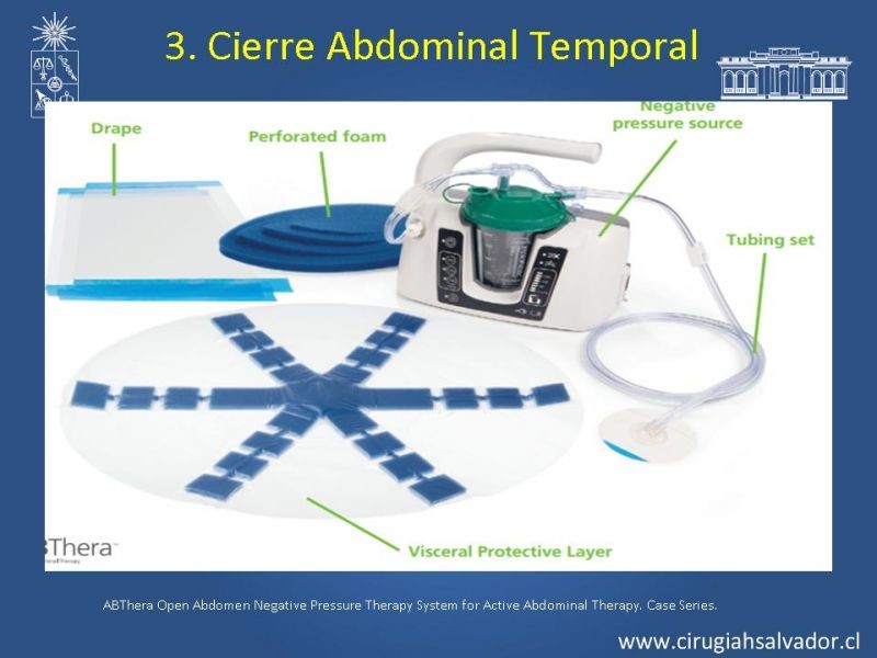 Diapositiva 15 de Damage Control Surgery (técnica quirúrgica) pt. 3
