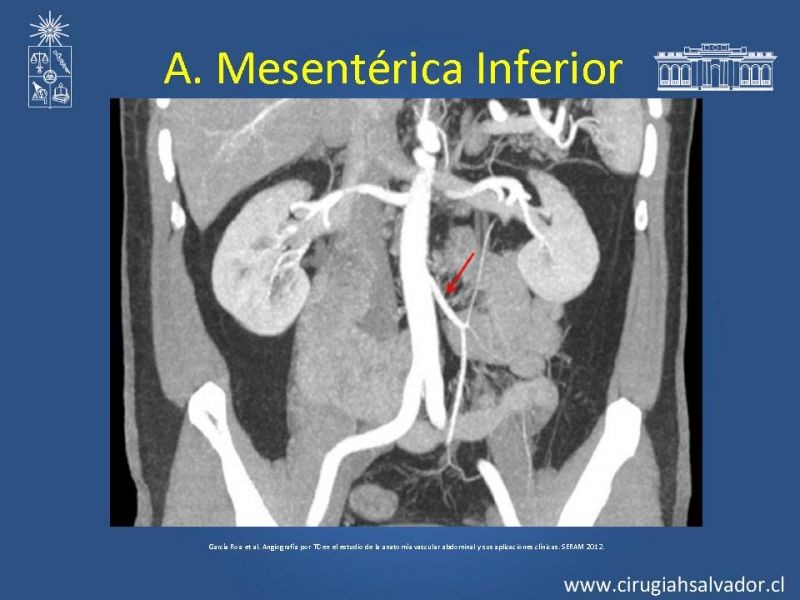 Diapositiva 37 de Anatomía e Imagenología Vascular Arterial Intra-abdominal