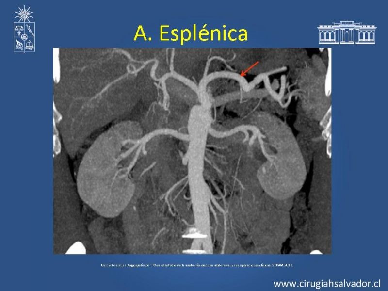 Diapositiva 23 de Anatomía e Imagenología Vascular Arterial Intra-abdominal