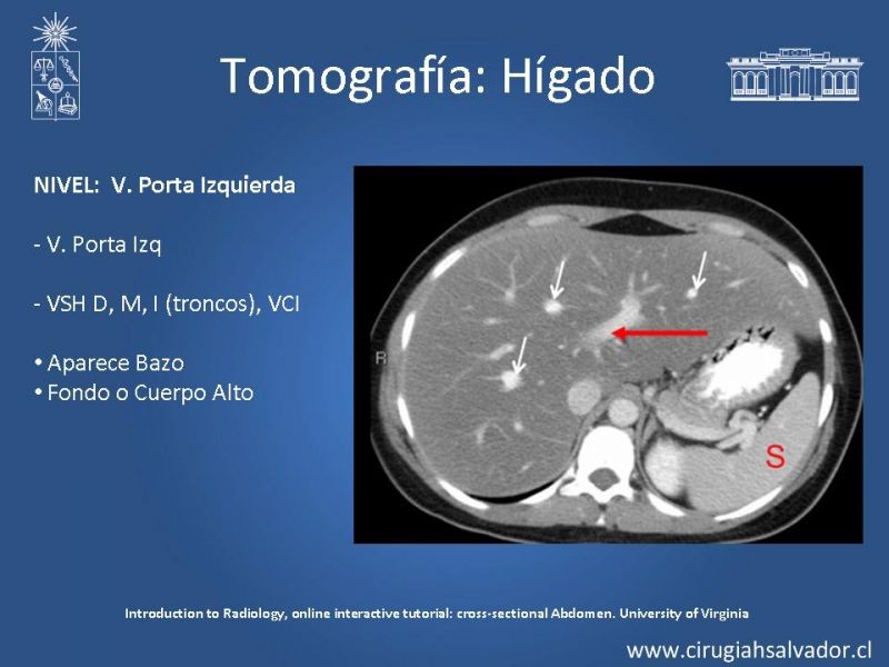 Diapositiva 27 de Anatomía Quirúrgica y Radiología Aplicada