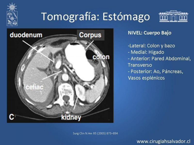 Diapositiva 24 de Anatomía Quirúrgica y Radiología Aplicada