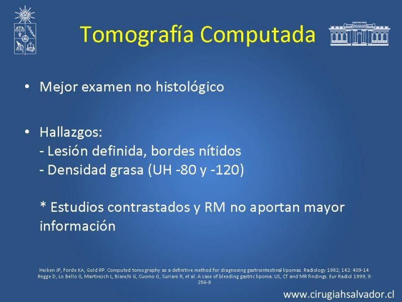 Diapositiva 10 de Lipoma Gástrico