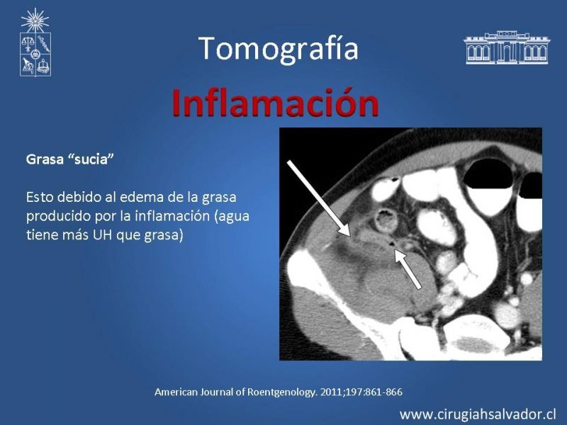 Diapositiva 39 de Anatomía Quirúrgica y Radiología Aplicada