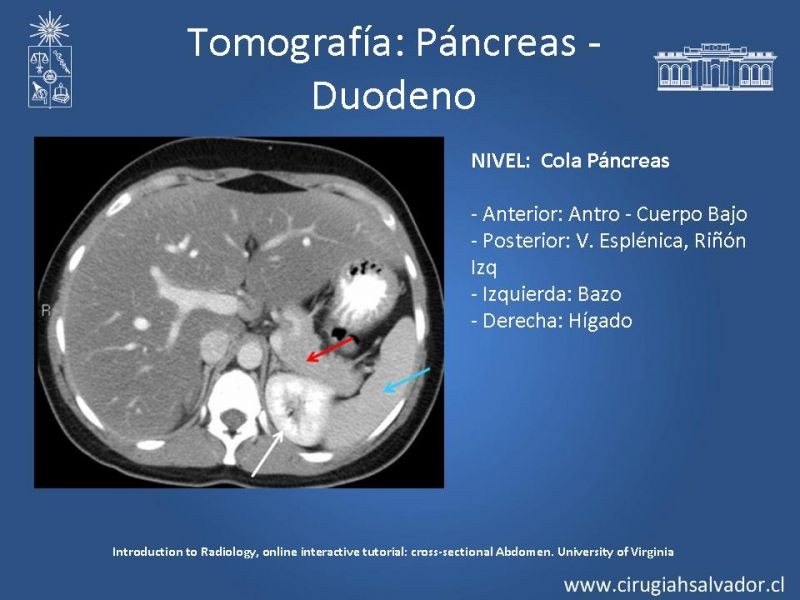 Diapositiva 35 de Anatomía Quirúrgica y Radiología Aplicada