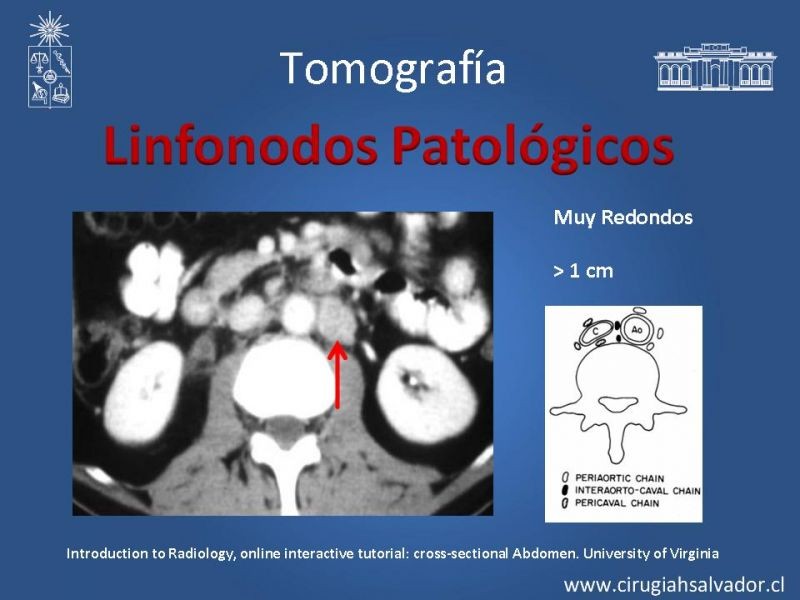 Diapositiva 41 de Anatomía Quirúrgica y Radiología Aplicada