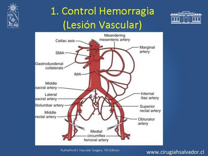 Diapositiva 8 de Damage Control Surgery (técnica quirúrgica) pt. 2