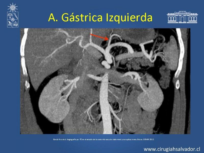 Diapositiva 26 de Anatomía e Imagenología Vascular Arterial Intra-abdominal