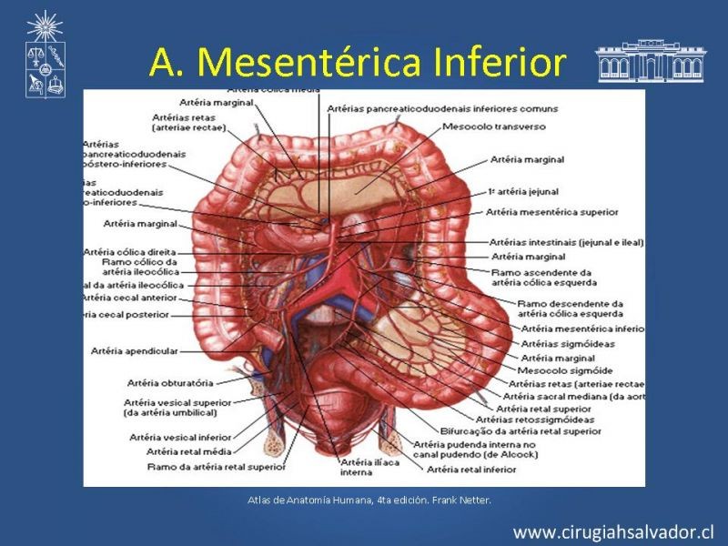 Diapositiva 49 de Damage Control Surgery (técnica quirúrgica) pt. 3