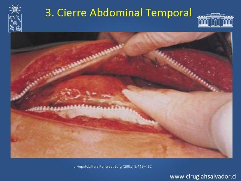 Diapositiva 6 de Damage Control Surgery (técnica quirúrgica) pt. 3