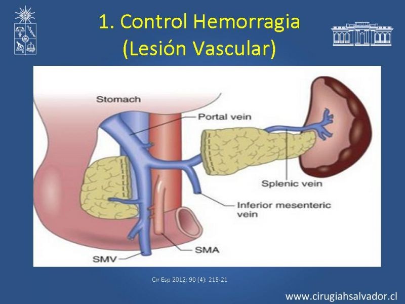 Diapositiva 13 de Damage Control Surgery (técnica quirúrgica) pt. 2