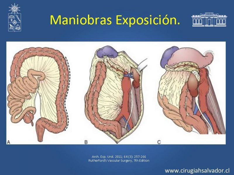 Diapositiva 17 de Damage Control Surgery (técnica quirúrgica) pt. 1