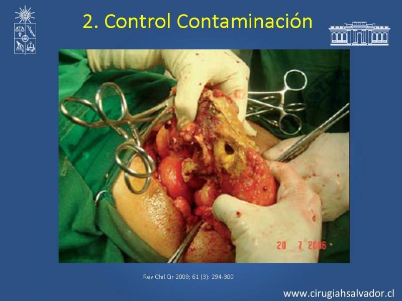 Diapositiva 29 de Damage Control Surgery (técnica quirúrgica) pt. 2
