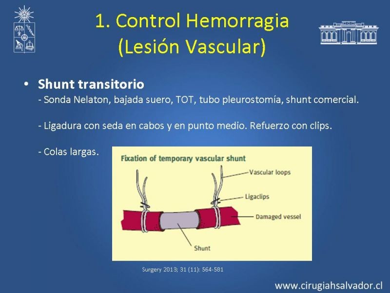 Diapositiva 20 de Damage Control Surgery (técnica quirúrgica) pt. 2
