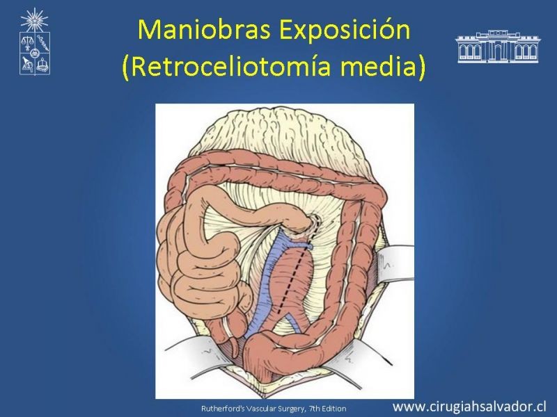 Diapositiva 19 de Damage Control Surgery (técnica quirúrgica) pt. 1
