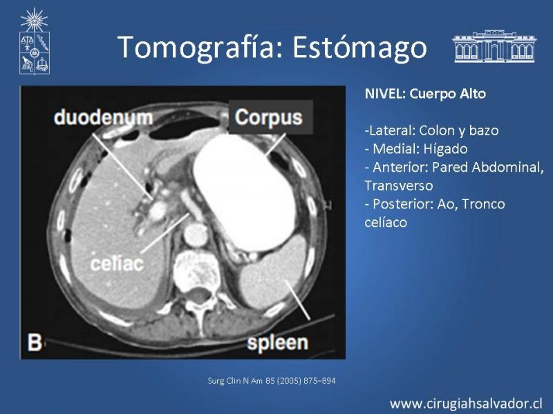Diapositiva 23 de Anatomía Quirúrgica y Radiología Aplicada