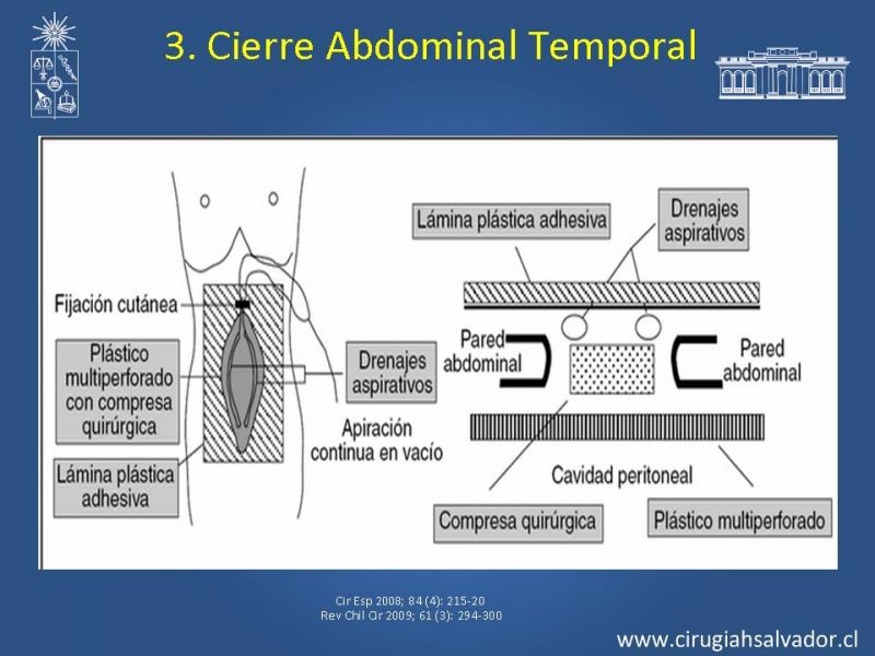 Diapositiva 11 de Damage Control Surgery (técnica quirúrgica) pt. 3