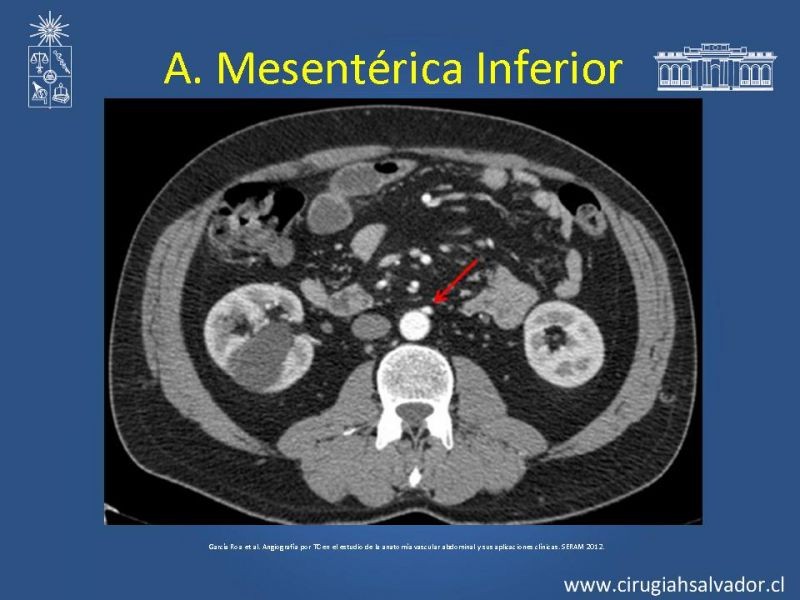 Diapositiva 36 de Anatomía e Imagenología Vascular Arterial Intra-abdominal