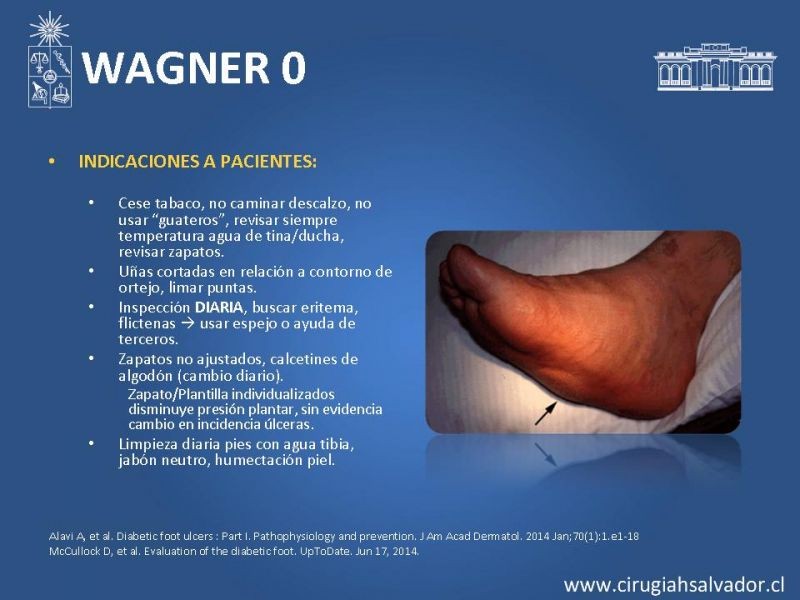 Diapositiva 6 de Pie diabético: Manejo