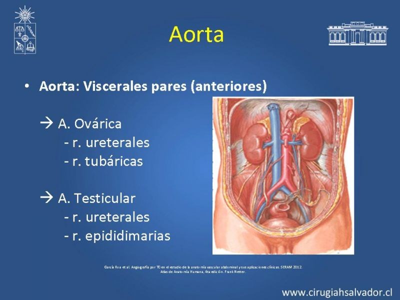 Diapositiva 5 de Anatomía e Imagenología Vascular Arterial Intra-abdominal