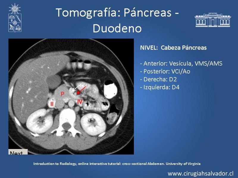 Diapositiva 33 de Anatomía Quirúrgica y Radiología Aplicada