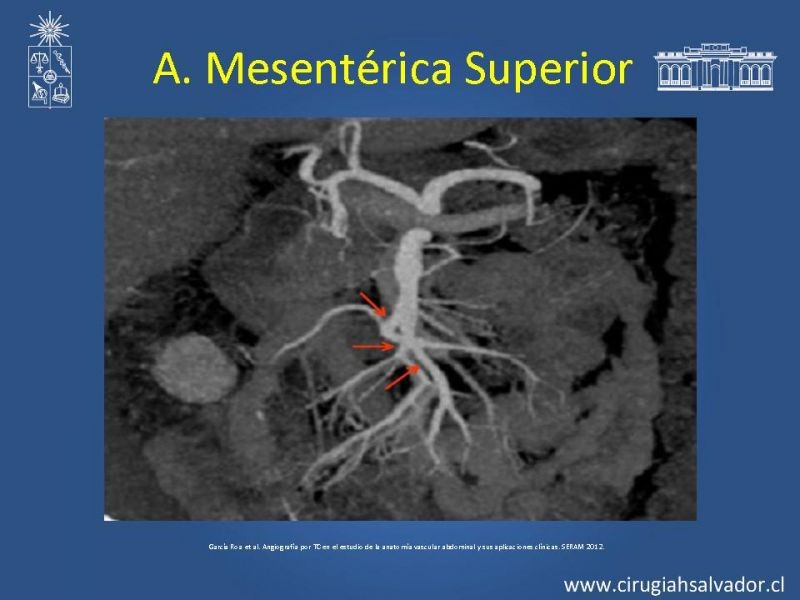 Diapositiva 33 de Anatomía e Imagenología Vascular Arterial Intra-abdominal