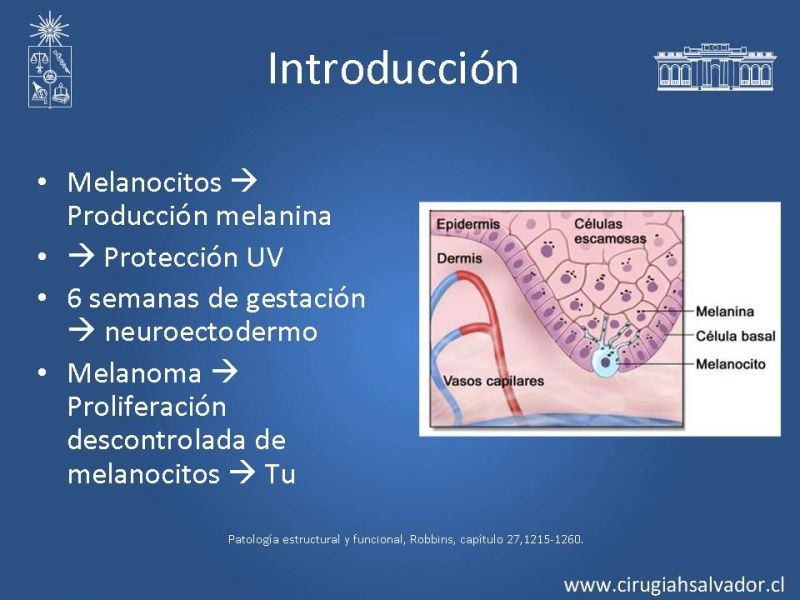 Diapositiva 1 de Melanoma