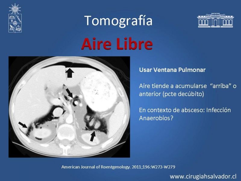 Diapositiva 38 de Anatomía Quirúrgica y Radiología Aplicada