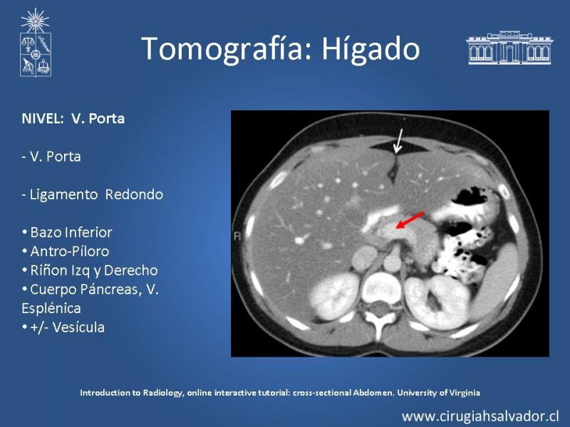 Diapositiva 29 de Anatomía Quirúrgica y Radiología Aplicada