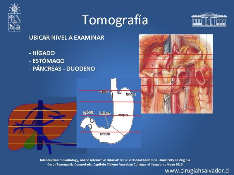 Diapositiva 21 de Anatomía Quirúrgica y Radiología Aplicada
