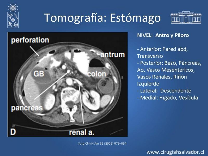 Diapositiva 25 de Anatomía Quirúrgica y Radiología Aplicada