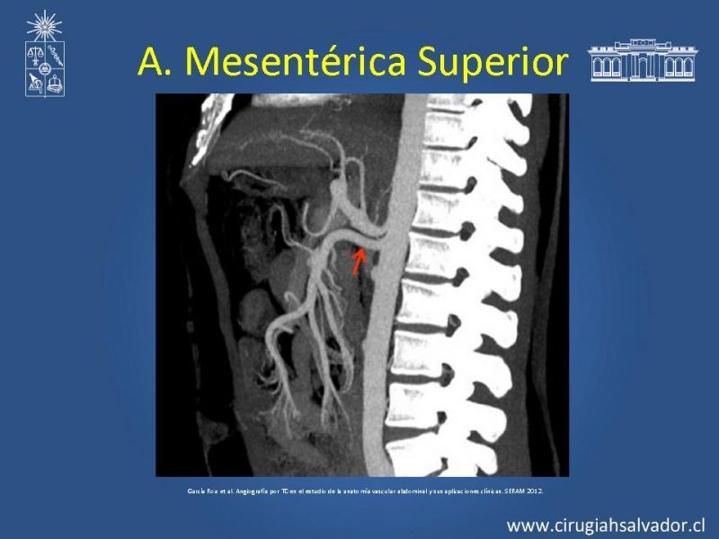 Diapositiva 28 de Anatomía e Imagenología Vascular Arterial Intra-abdominal