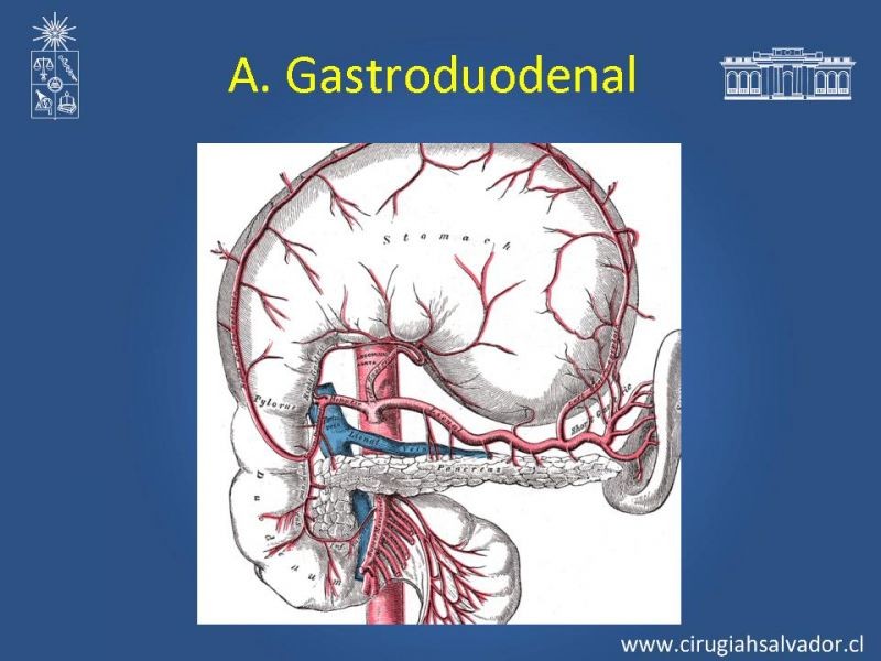 Diapositiva 36 de Damage Control Surgery (técnica quirúrgica) pt. 3