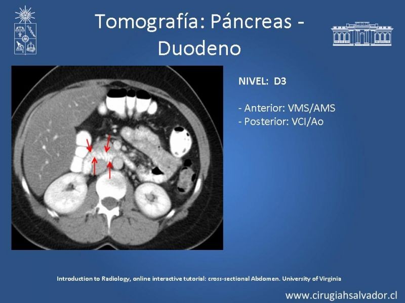 Diapositiva 31 de Anatomía Quirúrgica y Radiología Aplicada