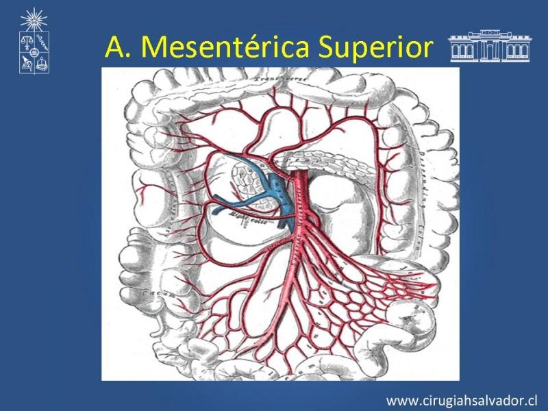 Diapositiva 47 de Damage Control Surgery (técnica quirúrgica) pt. 3