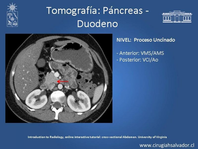 Diapositiva 32 de Anatomía Quirúrgica y Radiología Aplicada