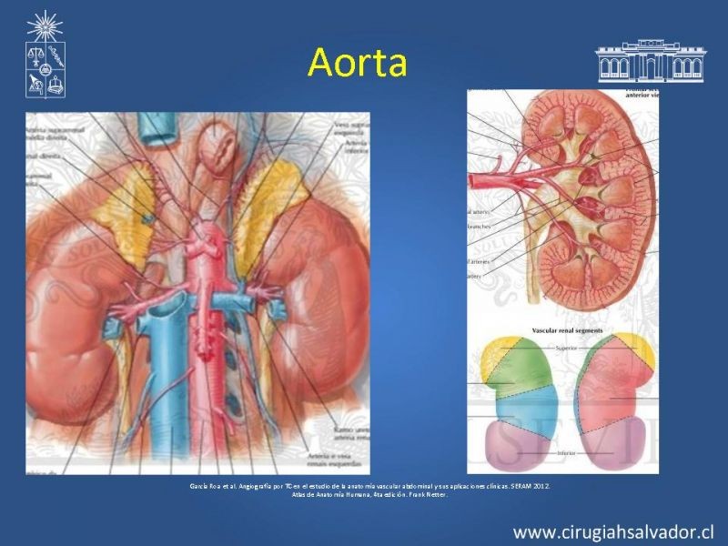 Diapositiva 29 de Damage Control Surgery (técnica quirúrgica) pt. 3
