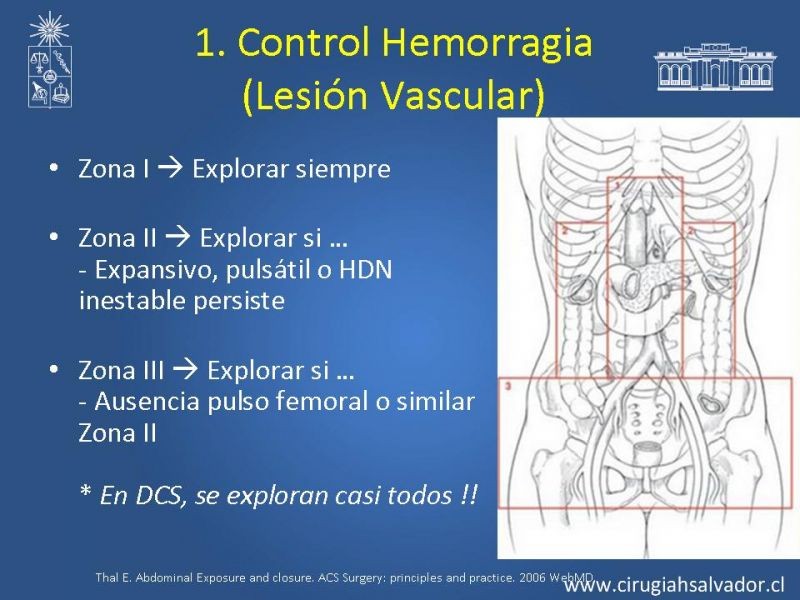 Diapositiva 9 de Damage Control Surgery (técnica quirúrgica) pt. 2