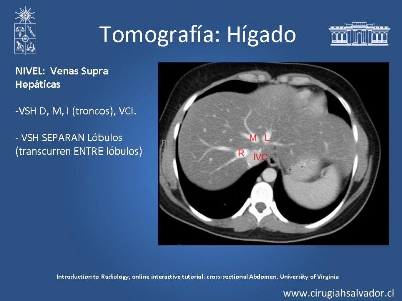Diapositiva 26 de Anatomía Quirúrgica y Radiología Aplicada