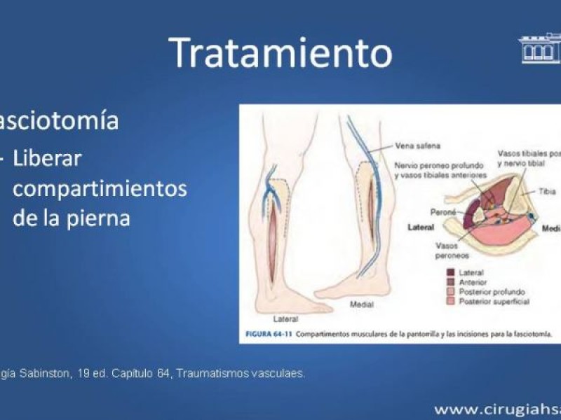Diapositiva 36 de Trauma Vascular: Extremidades inferiores
