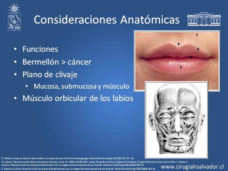 Diapositiva 3 de Reconstrucción peribucal