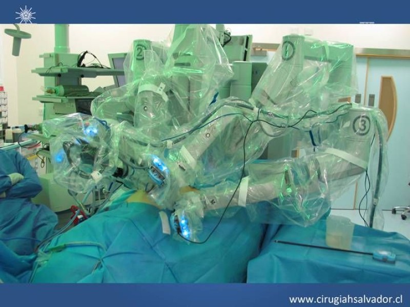 Diapositiva 4 de Robótica en Cirugía Digestiva y Bariátrica