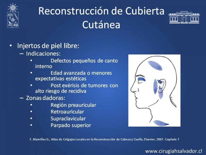 Diapositiva 10 de Reconstrucción Nasal