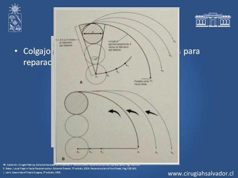 Diapositiva 36 de Reconstrucción peribucal