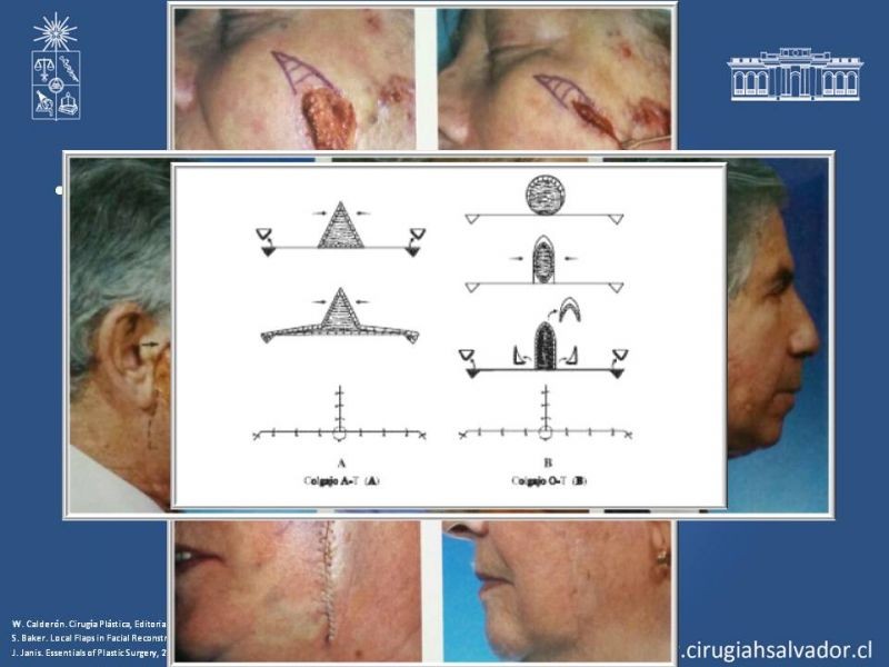 Diapositiva 52 de Reconstrucción peribucal