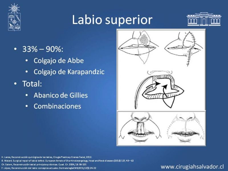 Diapositiva 11 de Reconstrucción peribucal