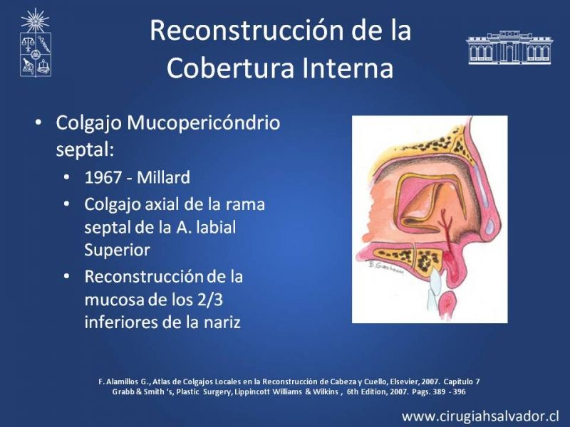 Diapositiva 31 de Reconstrucción Nasal