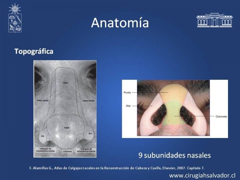 Diapositiva 4 de Reconstrucción Nasal