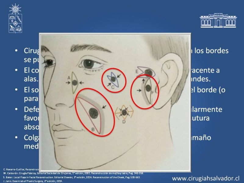 Diapositiva 28 de Reconstrucción peribucal